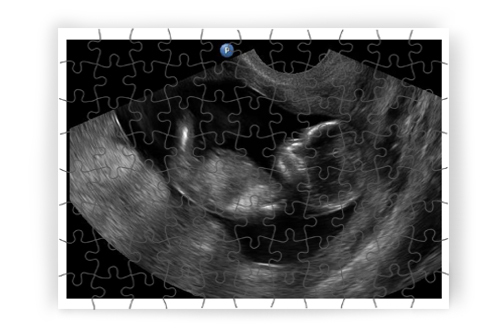 🤰🏻 Ultrahang kép - puzzle 🧩